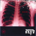 תמונה ממוזערת לגרסה מתאריך 11:05, 11 באוקטובר 2013